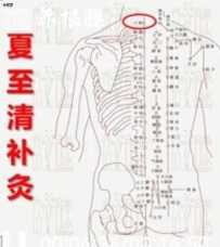 冬病夏治关键时实用技法